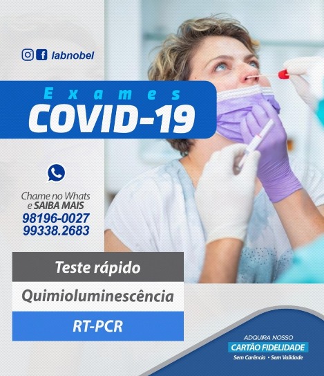 Covid19: Quais exames disponíveis atualmente!
